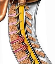canal cervical etroit definition